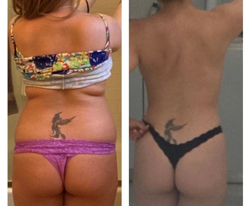 Before-and-after back and waist photos shown side by side